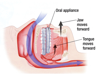 Oral